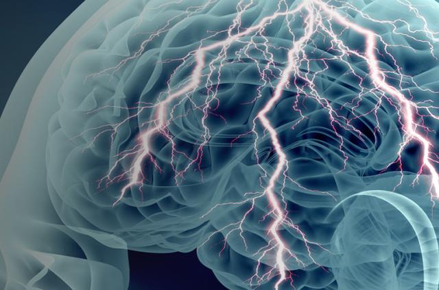 Brain banner